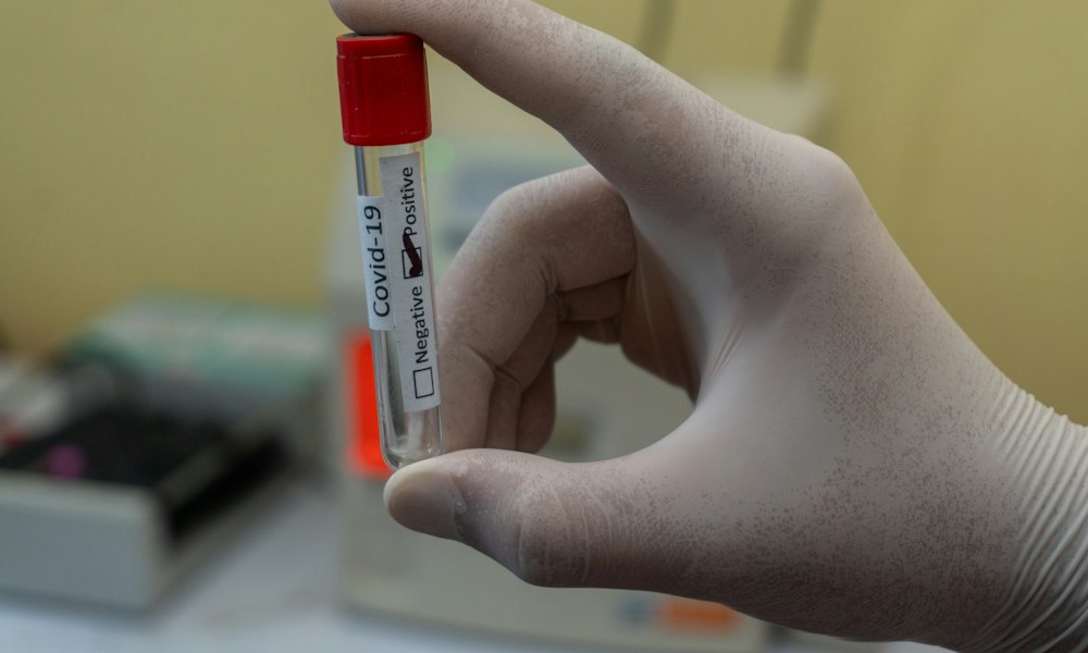 LGD-3303: Rechtsstatus und Anti-Doping-Regeln